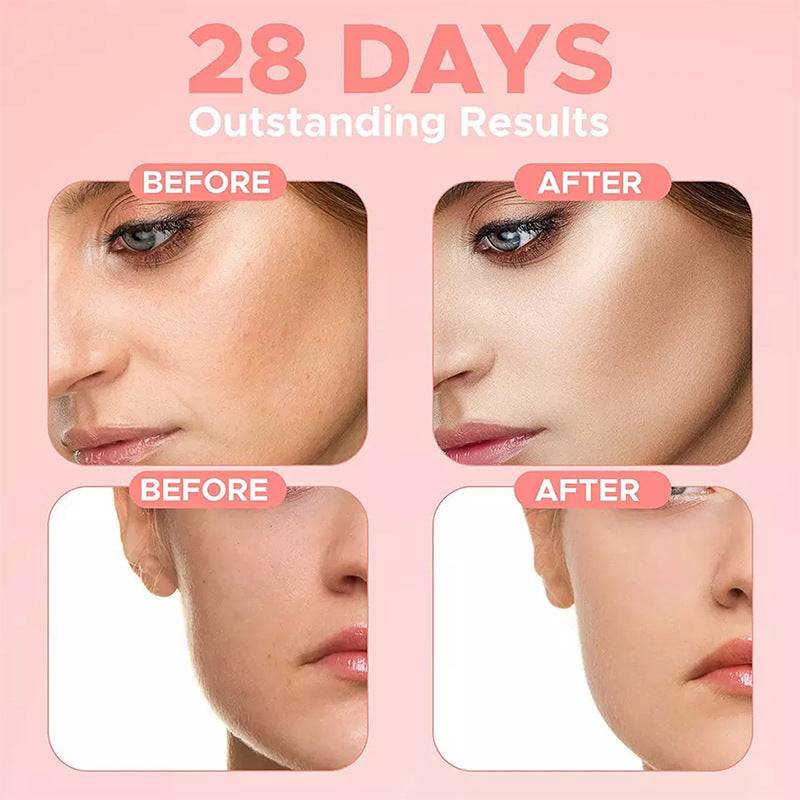 Face Serum Against Pigment Spots Anti Wrinkles Advance Skin Care 4 In 1