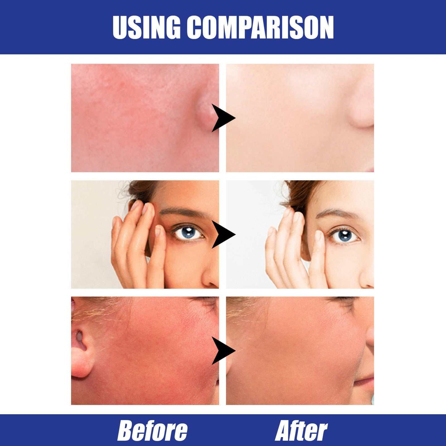 Sun cream Hyaluronic Acid Sun Stick Face Strong UV Protection